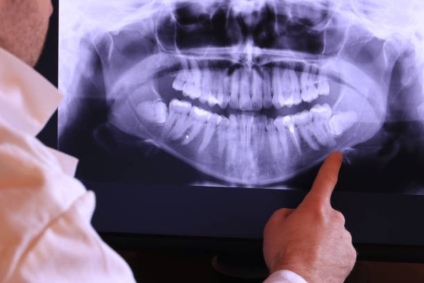 Best Emergency Root Canal Treatment in Abernathy, TX