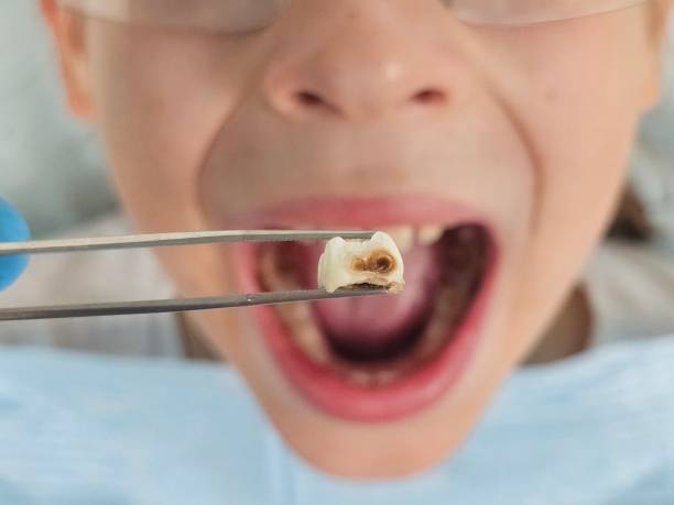 Best Pediatric Emergency Dentist in Abernathy, TX